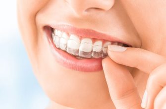 Что такое элайнеры и их особенности